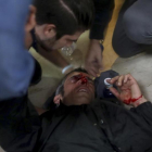 Un manifestante es atendido después de ser golpeado por una bala de goma disparada en la escuela Ramón Llull.