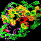 Islote pancreático de ratón en el que las células alfa productoras de glucagón (púrpura) se han etiquetado con una etiqueta fluorescente (verde). Algunos de ellos han comenzado a producir insulina (rojo), y aparecen como amarillo (combinación de verde y r