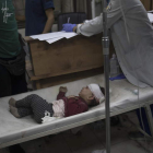Imagen de un niño atacado por una bomba israelí. HAITHAM IMAD