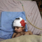 Un niño herido en los bombardeos de las fuerzas leales a Damasco recibe tratamiento en un hospital de Duma.