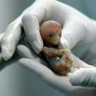 La malformación del feto dejara de estar recogida como razón suficiente para abortar.