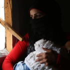 Una madre siria con su bebé desnutrido y enfermo.
