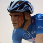 Marcel Kittel, con la cara ensangrentada en el Tour de Dubái, tras recibir un codazo de Andriy Grivko.