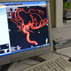 Unidad de Neurología del Hospital de León.