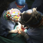 Detalle de una operación quirúrgica de trasplante de corazón en el Hospital de Córdoba. SALAS