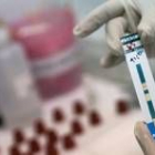 Un médico sostiene una muestra de sangre infectada con el VIH