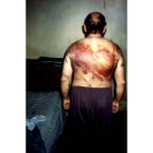 Uno de los presos iraquíes muestra las señales tras ser torturado