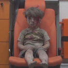Un niño sirio que sobrevive a un bombardeo aguarda en una ambulancia.