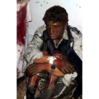 Imagen de uno de los heridos en el atentado de Pakistán