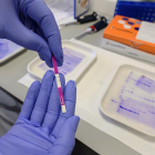 Las pruebas PCR ya no son prioritarias para la OMS por estos motivos