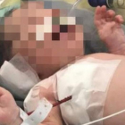 El pequeño Arthur en el hospital de Río de Janeiro.