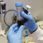 Estudio de un hígado en un laboratorio. MARCIANO PÉREZ