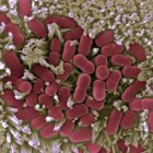 Imagen microscópica de la mucosa intestinal afectada por E.coli. CNB-CSIC