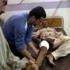 Un hombre iraquí es atendido en un hospital después de resultar herido