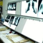El servicio de radiografías está parado por la huelga de sus trabajadores