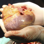 Un corazón donado, en manos del cirujano, listo para ser trasplantado a un paciente.