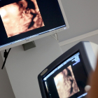 Un estudio investiga las afecciones cardíacas producidas a consecuencia de la exposición prenatal al alcohol. DL