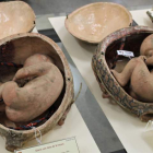 Dos reproducciones de fetos humanos formarán parte del futuro Museo Universitario.