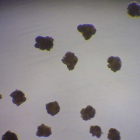 Cinco microfotografías de micobacterias. Tres de ellas son colonias crecidas en líquido de tres especies distintas y las otras dos son cultivos de macrófagos humanos infectados in vitro.