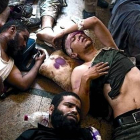 Seguidores de Mursi yacen heridos en el suelo de un hospital improvisado.