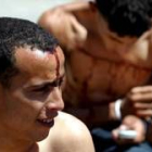 En una foto de archivo un marroquí herido sentado en Tarifa, tras atravesar el Estrecho