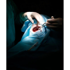 Intervención quirúrgica. jesús f. salvadores
