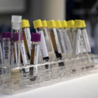 Pruebas ELISA ante el coronavirus: ¿Qué son y para qué sirven?