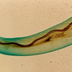 Angiostrongylus cantonensis, gusano pulmonar de las ratas. Wikimedia Commons / Punlop Anusonpornperm, CC BY-SA