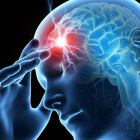 Ilustración de un hombre que padece migraña.