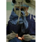 Realización de una intervención quirúrgica oftalmológica