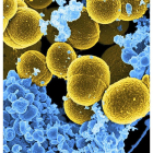 La bacteria staphylococcus aureus, en amarillo, incluida en la lista de la OMS.