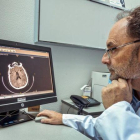 Jaume Roquer, jefe de Neurología del Hospital del Mar, analiza un TAC cerebral.