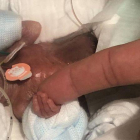 El bebé varón nacido con 268 gramos el pasago agosto en Japón.