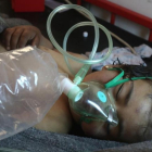 Un niño sirio recibe tratamiento tras el ataque con gass tóxico