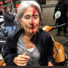 Una mujer con el rostro ensangrentado por las cargas policiales del 1-O
