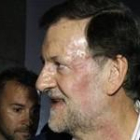 Rajoy sin gafas, tras la agresión que sufrió hoy en su paseo electoral por Pontevedra