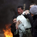 Imagen de un herido en una manifestación en Teherán. STRINGER