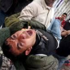 Un joven palestino llora de dolor tras perder parte de su pierna durante los enfrentamientos