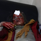 Una niña herida en los bombardeos de este jueves en Ghouta.