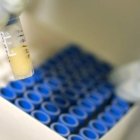 La terapia CART es el tratamiento con mejores resultados contra la leucemia. TIM WIMBORNE