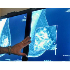 Un médico observa la mamografía de una paciente.