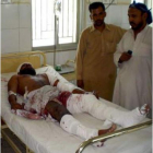 Un hombre se recupera de las heridas en un hospital.