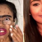 Una joven se une al #DontJudgeChallenge parodiando el espectacular cambio que sufre su rosto tras aplicarse una "crema milagrosa".