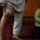 Mohammed muestra sus cicatrices junto a Zamir, su hijo menor.
