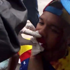 Willy Arteaga, herido.
