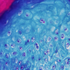 Imagen ampliada de una muestra de piel de un mono infectado con el virus. EFE