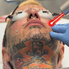 Borrón y cuenta nueva. La mujer más tatuada de Europa se borra los tatuajes de la cara.