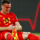 Vermaelen sangra tras una jugada en el partido ante Inglaterra.