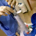 El diagnóstico precoz en esencial para combatir el cáncer de colon.