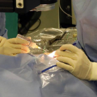 El equipo de oftalmología del Hospital de León realiza una operación.